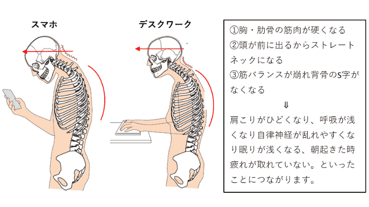 猫背になる原因の画像