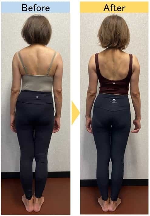 月島でダイエットに成功した女性のビフォーアフター Bikin 女性の為のパーソナルトレーニング